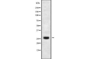 Western blot analysis of CLDN14 using HuvEc whole cell lysates (CLDN14 抗体  (C-Term))