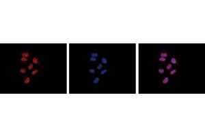 Immunofluorescence Microscopy of anti-Pol II antibody Immunofluorescence Microscopy results of Mouse anti-Pol II antibody. (POLR2A/RPB1 抗体)