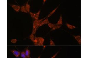 Immunofluorescence analysis of NIH/3T3 cells using AKR1C3 Polyclonal Antibody at dilution of 1:100.