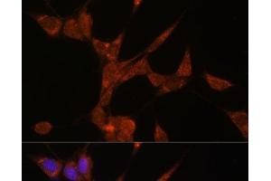 Immunofluorescence analysis of NIH/3T3 cells using AKR1C3 Polyclonal Antibody at dilution of 1:100. (AKR1C3 抗体)