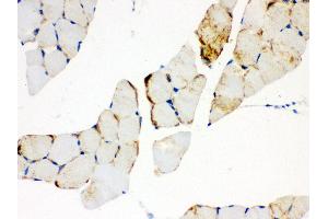 Anti- CPT1B Picoband antibody, IHC(P) IHC(P): Mouse Skeletal Muscle Tissue (CPT1B 抗体  (N-Term))