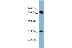 WB Suggested Anti-HIRIP3 Antibody Titration: 0. (HIRIP3 抗体  (Middle Region))