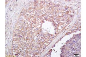 Immunohistochemistry (Paraffin-embedded Sections) (IHC (p)) image for anti-NLR Family, Pyrin Domain Containing 4 (NLRP4) (AA 351-450) antibody (ABIN872353)