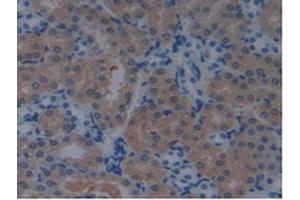 Detection of PDCD6IP in Mouse Kidney Tissue using Polyclonal Antibody to Programmed Cell Death Protein 6 Interacting Protein (PDCD6IP) (ALIX 抗体  (AA 1-239))