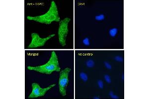 ABIN6391351 Immunofluorescence analysis of paraformaldehyde fixed HeLa cells, permeabilized with 0. (TRPC1 抗体  (Internal Region))