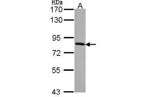 Western Blotting (WB) image for anti-Hydroxysteroid (17-Beta) Dehydrogenase 4 (HSD17B4) (N-Term) antibody (ABIN2856979)