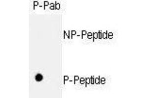 Dot Blot (DB) image for anti-Retinoblastoma 1 (RB1) (pSer811) antibody (ABIN3001786)