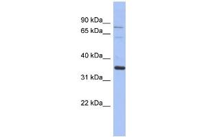 WB Suggested Anti-NRBP2 Antibody Titration: 0. (NRBP2 抗体  (Middle Region))