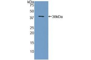 Western blot analysis of recombinant Human MBP. (MBP 抗体  (AA 135-190))