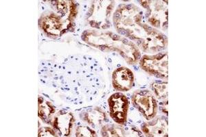 Immunohistochemistry analysis in formalin fixed and paraffin embedded human kidney tissue reacted with PDZK1 Antibody (Center) followed by peroxidase conjugation of the secondary antibody and DAB staining. (PDZK1 抗体  (Middle Region))