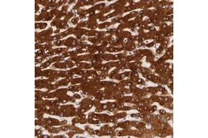 Immunohistochemical staining of human liver with PACS2 polyclonal antibody  shows strong cytoplasmic positivity in hepatocytes at 1:50-1:200 dilution.