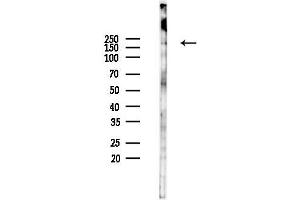 Western blot analysis of lysates from F10-LUC cells(heat-shock 45 min treatment), using Phospho-GRF-1 (Tyr1105) Antibody at 1/1000 dilution.