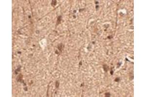 Immunohistochemistry of Slitrk3 in human brain tissue with AP30802PU-N Slitrk3 antibody at 2. (SLITRK3 抗体  (C-Term))