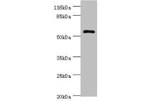 Western blot All lanes: DPH2 antibody at 2 μg/mL + Mouse brain tissue Secondary Goat polyclonal to rabbit IgG at 1/10000 dilution Predicted band size: 53, 28, 39 kDa Observed band size: 53 kDa (DPH2 抗体  (AA 1-489))