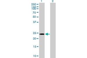 Western Blotting (WB) image for anti-Polymerase (RNA) II (DNA Directed) Polypeptide E, 25kDa (POLR2E) (AA 1-210) antibody (ABIN519028)