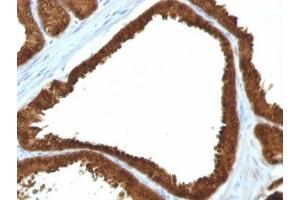 Immunohistochemistry (IHC) image for anti-Isocitrate Dehydrogenase 1 (NADP+), Soluble (IDH1) (AA 280-420) antibody (ABIN3025025)