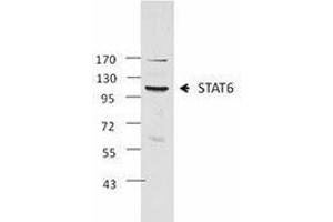 Western Blotting (WB) image for anti-Signal Transducer and Activator of Transcription 6, Interleukin-4 Induced (STAT6) antibody (ABIN2666296) (STAT6 抗体)