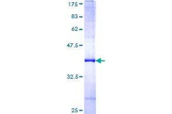 FBXL7 Protein (AA 392-489) (GST tag)