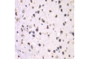 Immunohistochemistry of paraffin-embedded mouse brain using PRMT5 antibody at dilution of 1:100 (x40 lens). (PRMT5 抗体)