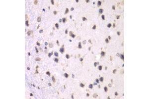 Immunohistochemistry of paraffin-embedded mouse brain using PRMT5 antibody at dilution of 1:100 (x40 lens).