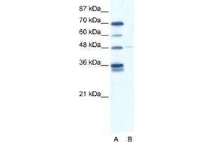 Western Blotting (WB) image for anti-GLIS Family Zinc Finger 2 (GLIS2) antibody (ABIN2460153) (GLIS2 抗体)