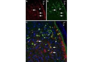 Immunohistochemistry (IHC) image for anti-Sodium Channel, Voltage-Gated, Type II, alpha Subunit (SCN2A) (AA 467-485), (Intracellular) antibody (ABIN7043640)