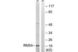 Western blot analysis of extracts from Jurkat cells, using MRPL54 Antibody. (MRPL54 抗体  (AA 81-130))
