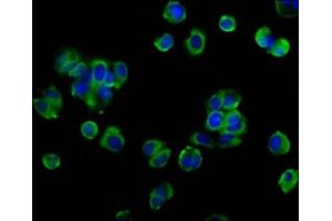 Immunofluorescence staining of MCF-7 cells with ABIN7162123 at 1:133, counter-stained with DAPI. (Occludin 抗体  (AA 285-430))