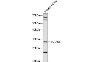 Western blot analysis of extracts of Mouse kidney, using TSP antibody (ABIN7270790) at 1:1000 dilution. (Tetraspanin 6 抗体  (AA 120-200))