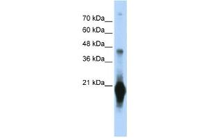 Western Blotting (WB) image for anti-Chromosome 17 Open Reading Frame 49 (C17orf49) antibody (ABIN2459653) (C17orf49 抗体)