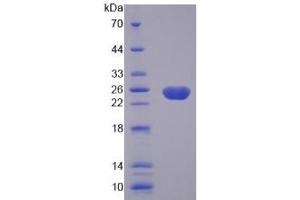 SDS-PAGE of Protein Standard from the Kit  (Highly purified E. (Caspase 8 ELISA 试剂盒)
