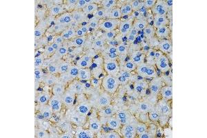 Immunohistochemistry (Paraffin-embedded Sections) (IHC (p)) image for anti-V-Raf-1 Murine Leukemia Viral Oncogene Homolog 1 (RAF1) (AA 190-350) antibody (ABIN3020713)