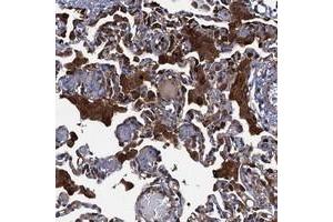 Immunohistochemical staining of human lung with DNHD1 polyclonal antibody  shows strong cytoplasmic positivity in macrophages. (DNHD1 抗体)