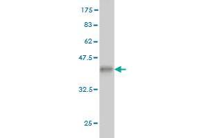 Western Blot detection against Immunogen (36. (BCS1L 抗体  (AA 320-418))