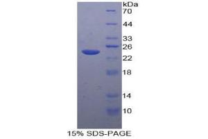SDS-PAGE analysis of Human Tachykinin Receptor 2 Protein. (TACR2 蛋白)