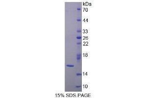 SDS-PAGE (SDS) image for Lectin, Galactoside-Binding, Soluble, 9B (LGALS9B) (AA 17-148) protein (His tag) (ABIN1170504) (LGALS9B Protein (AA 17-148) (His tag))