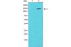 Western blot analysis of p130 Cas expression in NIH-3T3 whole cell lysates,The lane on the left is treated with the antigen-specific peptide. (BCAR1 抗体  (Internal Region))