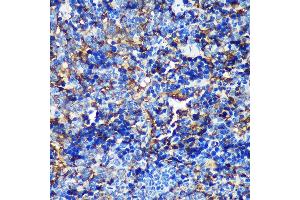 Immunohistochemistry (IHC) image for anti-Cullin-Associated and Neddylation-Dissociated 2 (CAND2) (AA 850-1000) antibody (ABIN7266547)