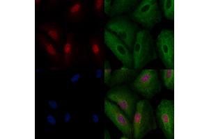 ABIN6258311 and ABIN6274239 staining  cells by IF/ICC. (RORA 抗体  (N-Term))