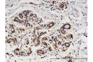 Immunoperoxidase of monoclonal antibody to GNA14 on formalin-fixed paraffin-embedded human breast. (GNa14 抗体  (AA 150-250))