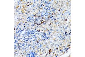 Immunohistochemistry of paraffin-embedded rat spleen using C Rabbit mAb (ABIN7266125) at dilution of 1:100 (40x lens). (CARD11 抗体)