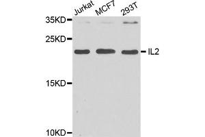 Western blot analysis of extract of various cells, using IL2 antibody. (IL-2 抗体)