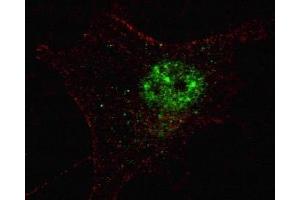 Fluorescent confocal image of SY5Y cells stained with PDX1 antibody. (PDX1 抗体  (AA 1-30))