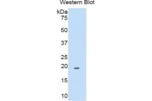 Western Blotting (WB) image for Biglycan (BGN) ELISA Kit (ABIN6720596)