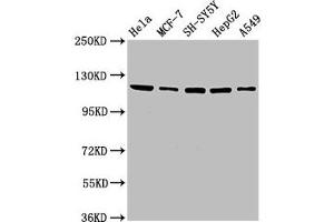 Western Blot Positive WB detected in: Hela whole cell lysate, MCF-7 whole cell lysate, SH-SY5Y whole cell lysate, HepG2 whole cell lysate, A549 whole cell lysate All lanes: USP48 antibody at 3. (USP48 抗体  (AA 358-508))