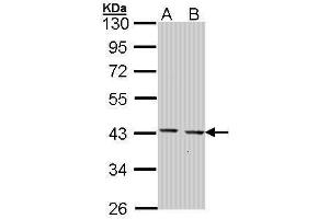 WB Image Sample (30 ug of whole cell lysate) A: Hep G2 , B: Molt-4 , 10% SDS PAGE antibody diluted at 1:1000 (GULP1 抗体  (C-Term))