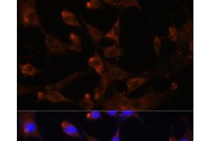 Immunofluorescence analysis of NIH-3T3 cells using CAD Polyclonal Antibody at dilution of 1:100. (CAD 抗体)