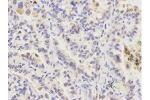 Immunohistochemistry (IHC) image for anti-Autophagy related 4A Cysteine Peptidase (ATG4A) antibody (ABIN1871138) (ATG4A 抗体)