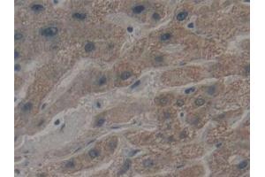 Detection of MYH10 in Human Liver Tissue using Polyclonal Antibody to Myosin Heavy Chain 10, Non Muscle (MYH10) (MYH10 抗体  (AA 438-716))