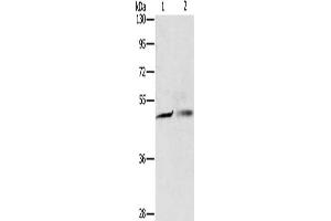 Gel: 8 % SDS-PAGE, Lysate: 40 μg, Lane 1-2: A549 cells, A375 cells, Primary antibody: ABIN7130597(PGBD4 Antibody) at dilution 1/250, Secondary antibody: Goat anti rabbit IgG at 1/8000 dilution, Exposure time: 5 seconds (PGBD4 抗体)